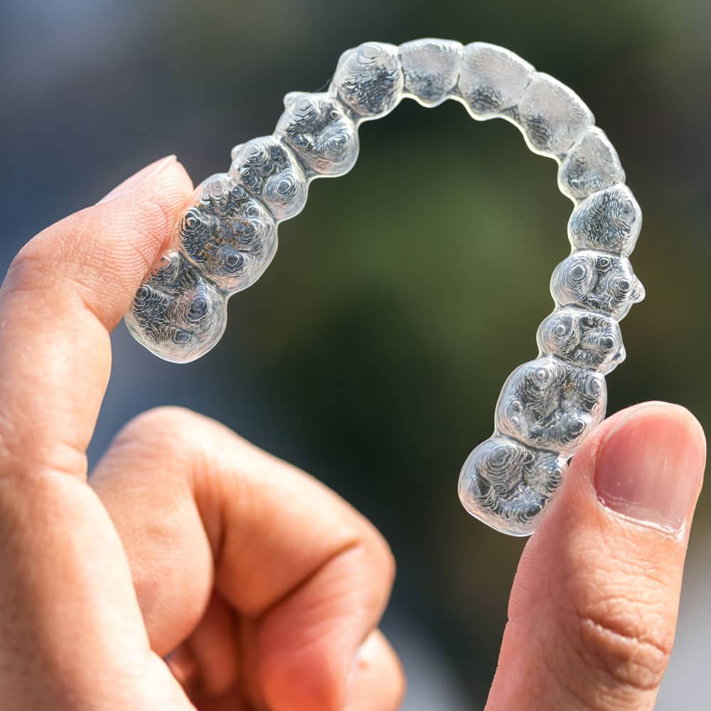 Invisalign clear aligners